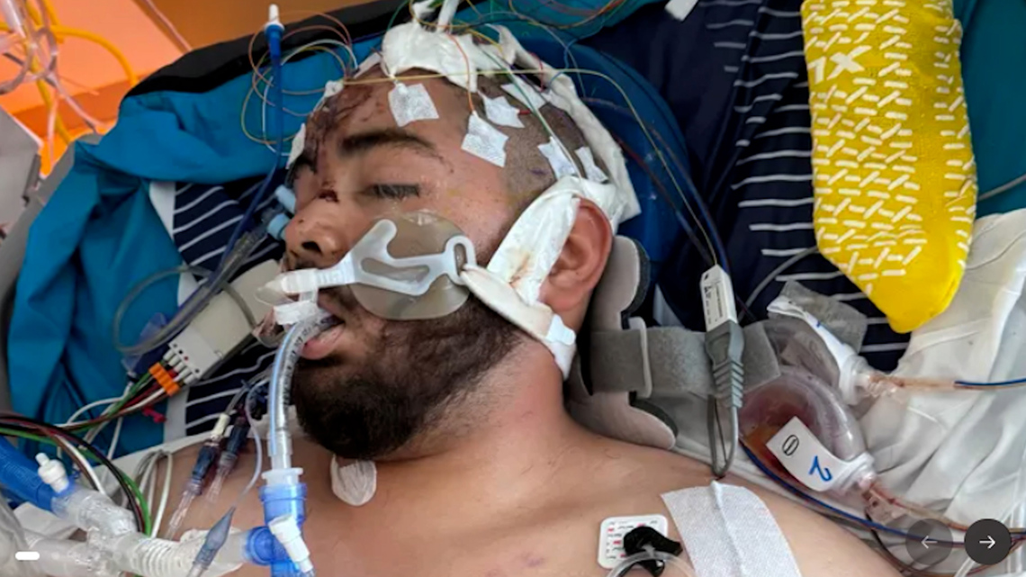 San Antonio Tow Truck Driver Returns Home After 137 Days Following Loop 410 Accident