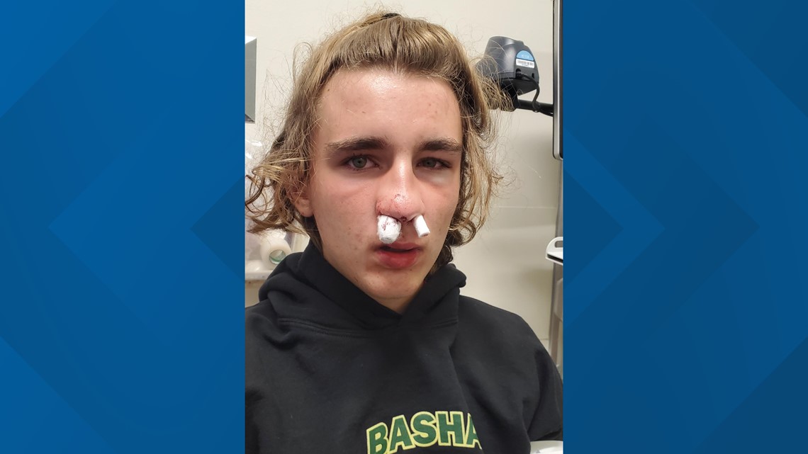 A high school soccer player was knocked out during a game. His parents want AIA rules changed after watching it on livestream. - Vimarsana News