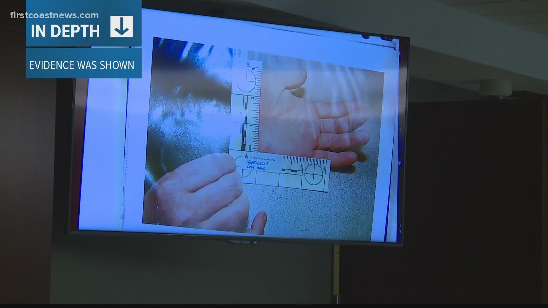 Among the evidence presented to the jury were pictures of wounds Kessler received.