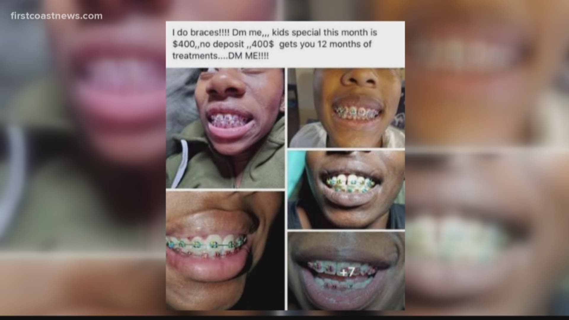 First Coast doctors are warning parents to be aware of a woman's offer to fit braces for $400 from home, citing health and safety reasons.