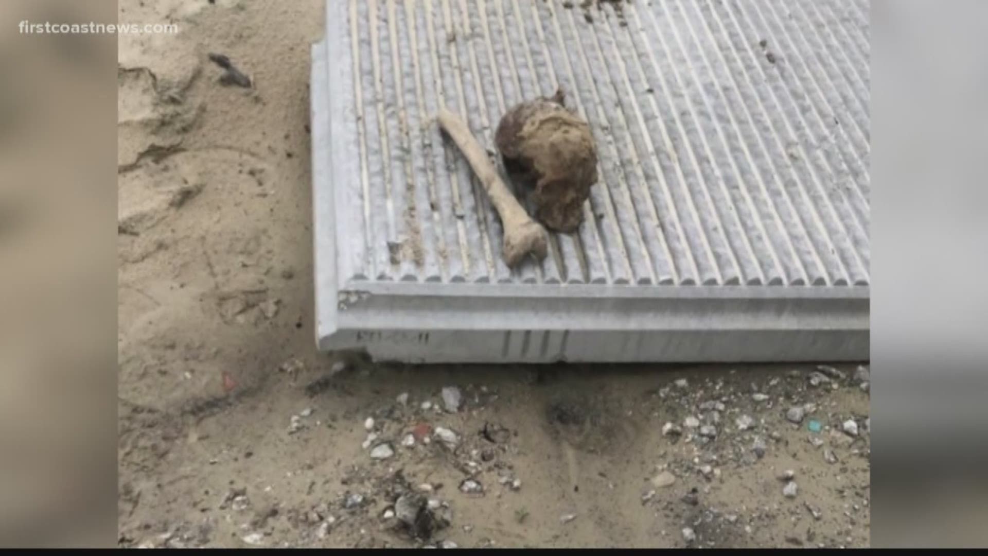 A day after human bones were found at a construction site in Jacksonville, a seasoned forensic expert describes what investigators are up against.