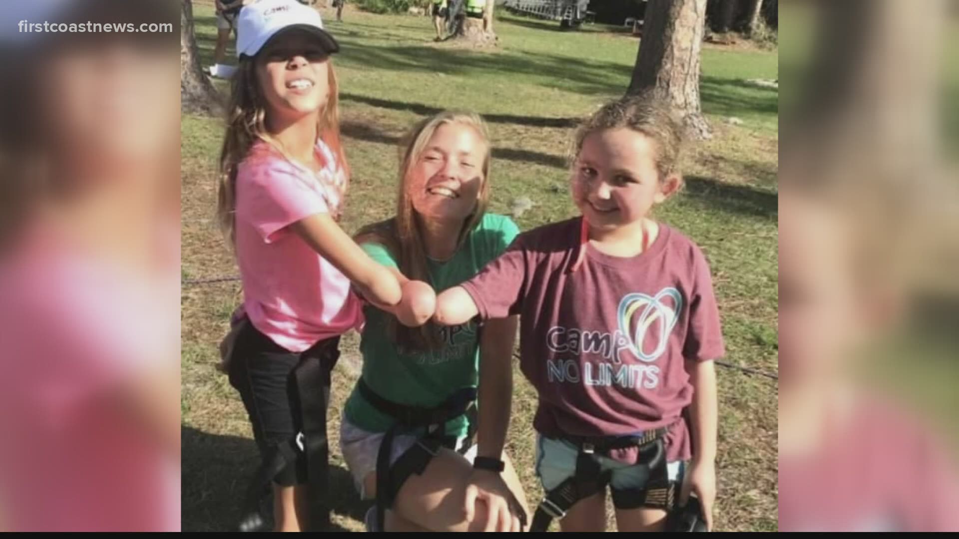 Camp No Limits: Free virtual camp this weekend for children with limb loss, their families