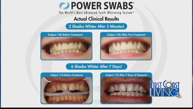 FCL - Wednesday December 23rd: Power Swabs Teeth Whitening (Sponsored by Power Swabs)