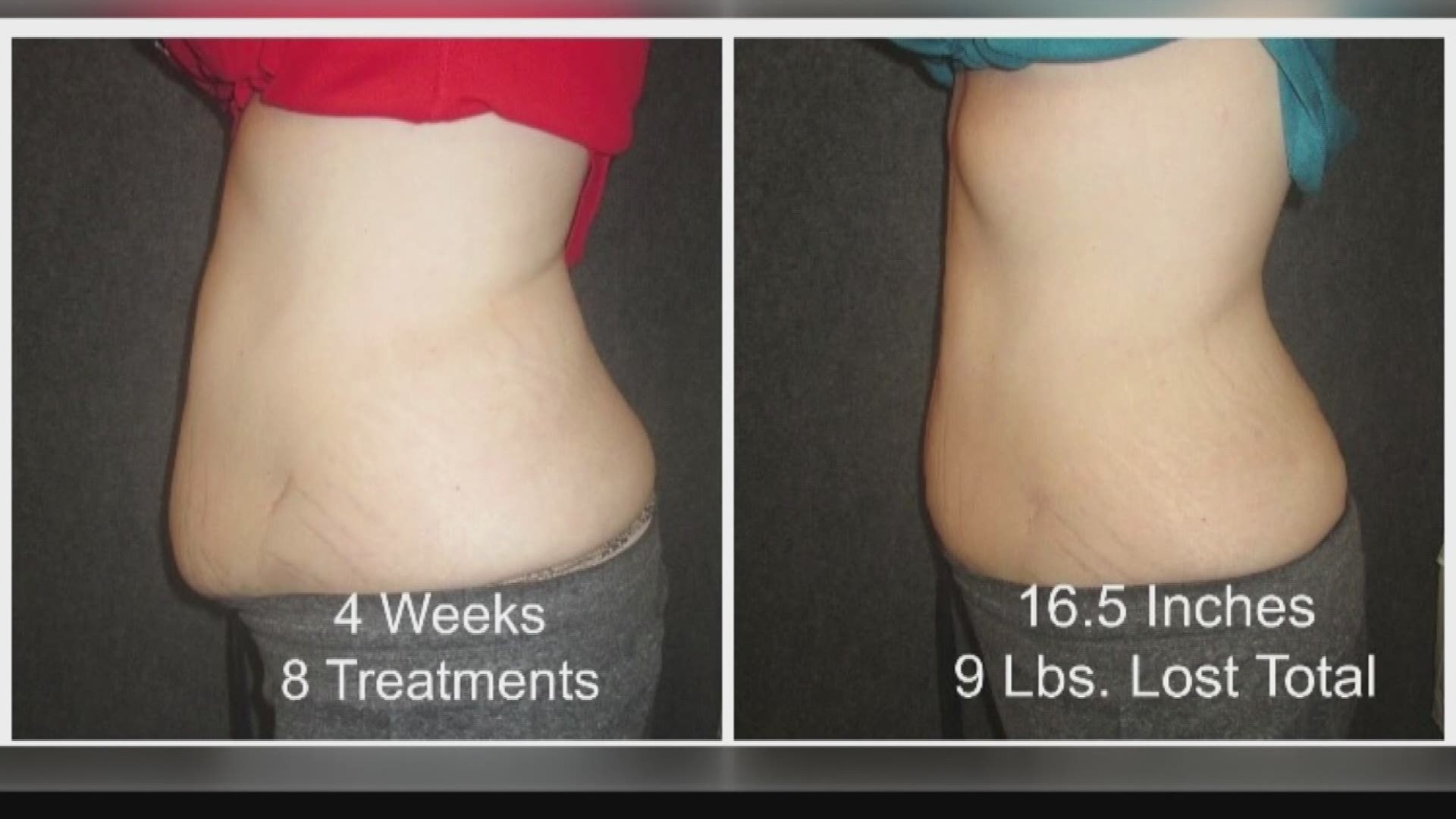 Lose inches on your waist in minutes with the help of i-Lipo (FCL