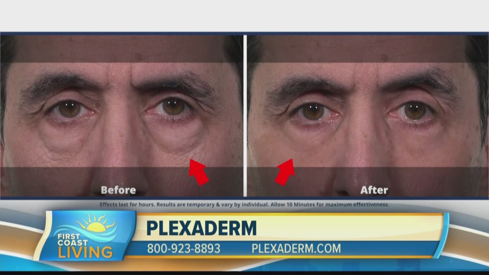 Check out Plexaderm if you're trying to get rid of those key signs of aging!