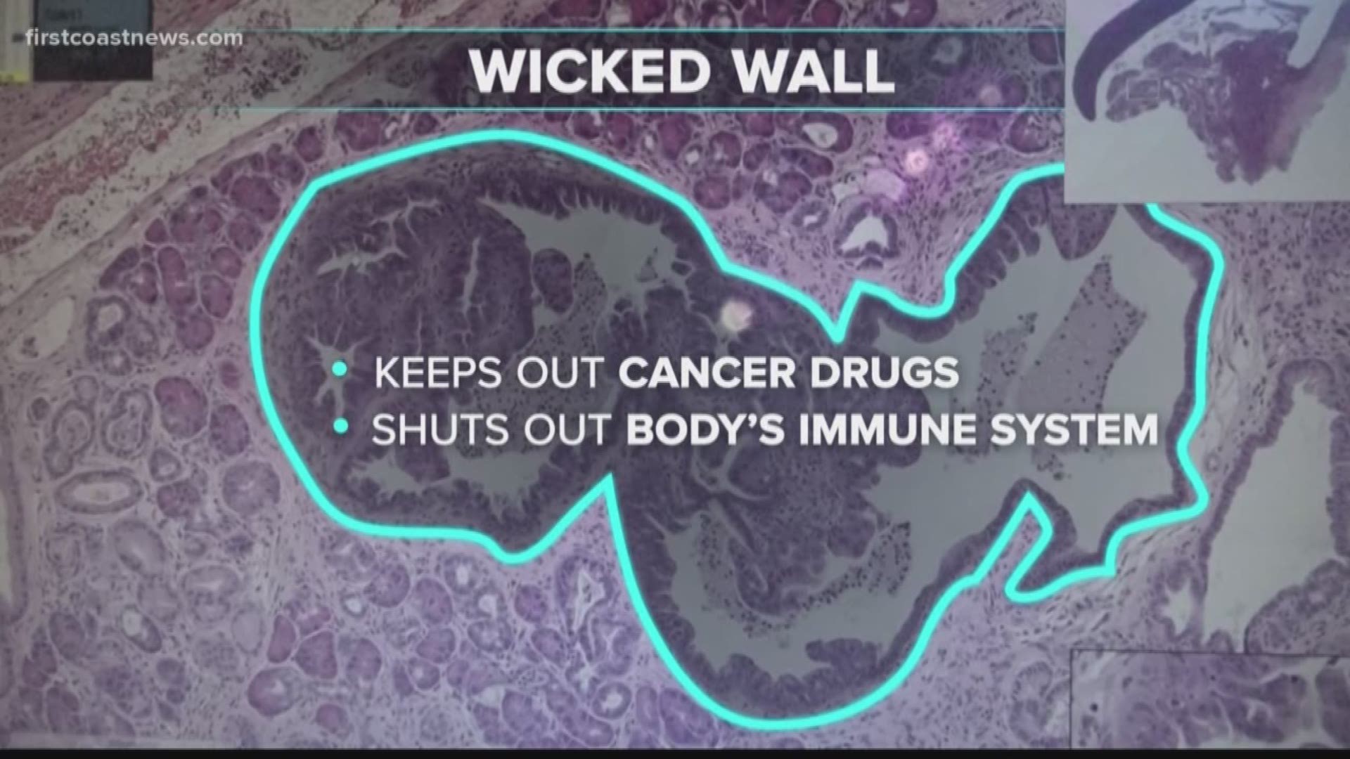 We go to Mayo Clinic-Jacksonville and talk with researchers about the 'Wicked Wall.'