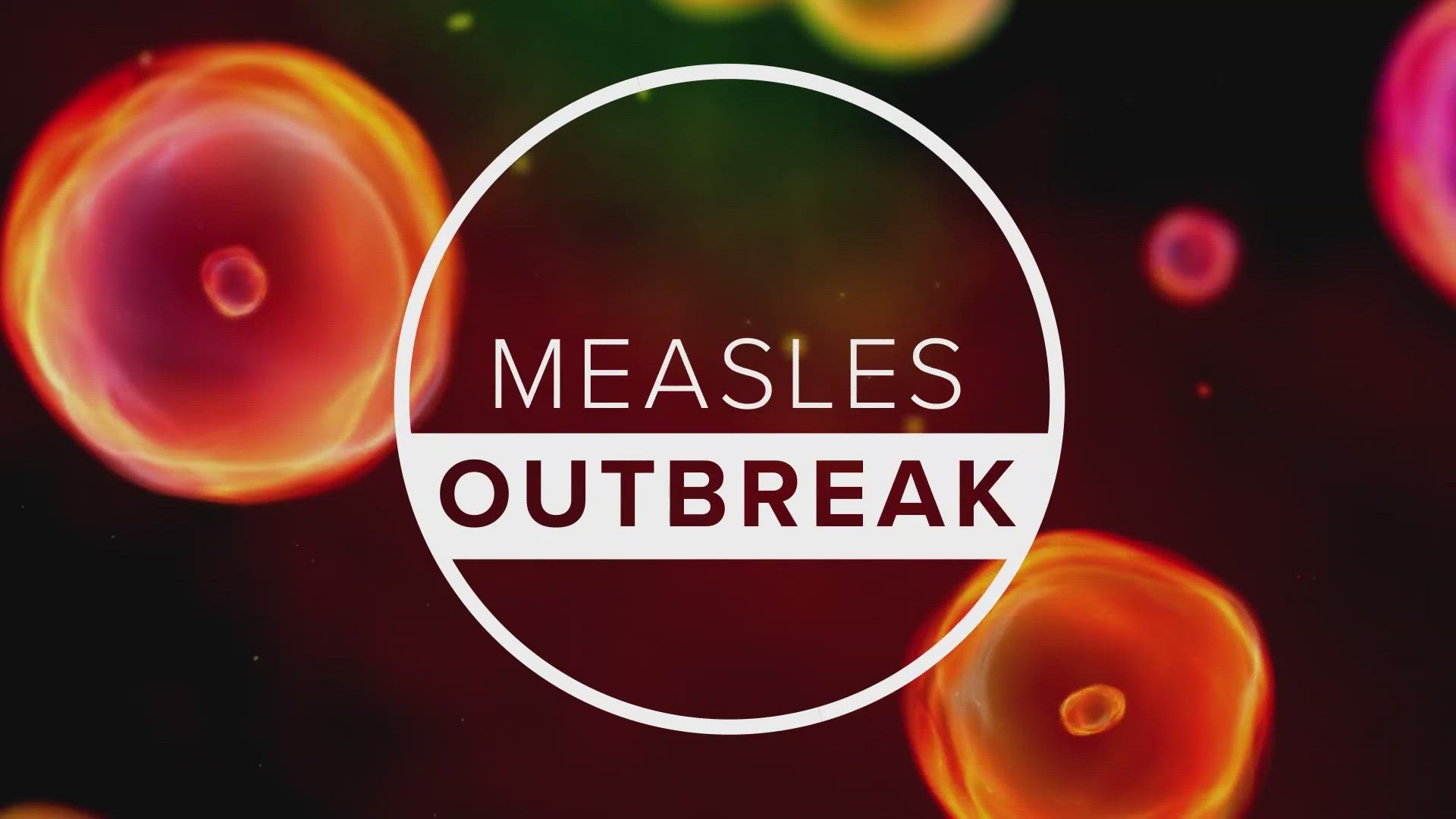 The City of Jacksonville said in a statement that measles cases could pop up in Northeast Florida due to Spring Break.