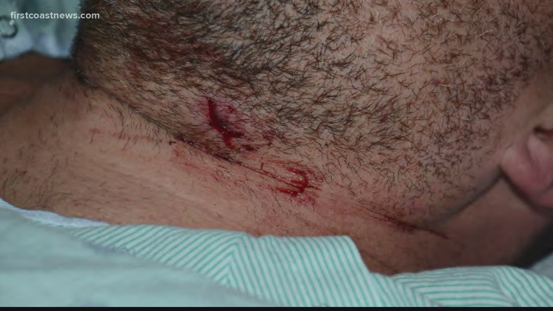 Photographs show the injuries sustained by the officer who survived thanks to his body armor.