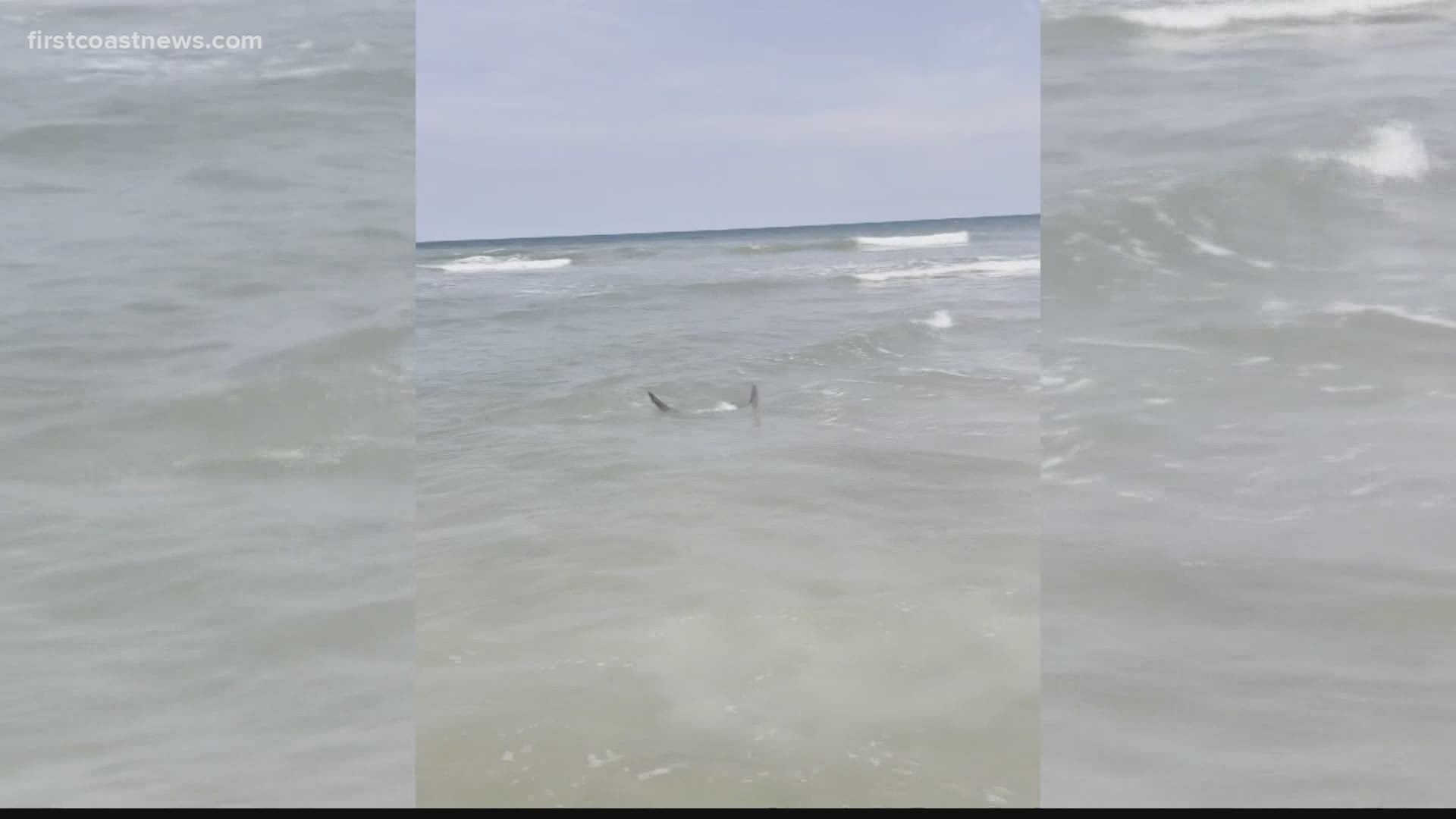 13-year-old girl bitten by shark in Fernandina Beach