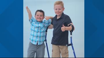 Camp No Limits: Free virtual camp this weekend for children with limb loss, their families