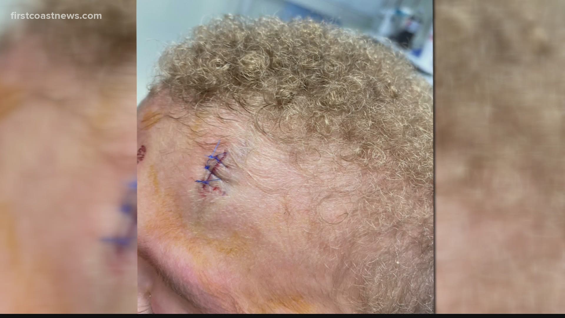 Sara Hastings says her 5-year-old son was pushed by another student Tuesday afternoon, leaving him with deep cuts to his forehead.