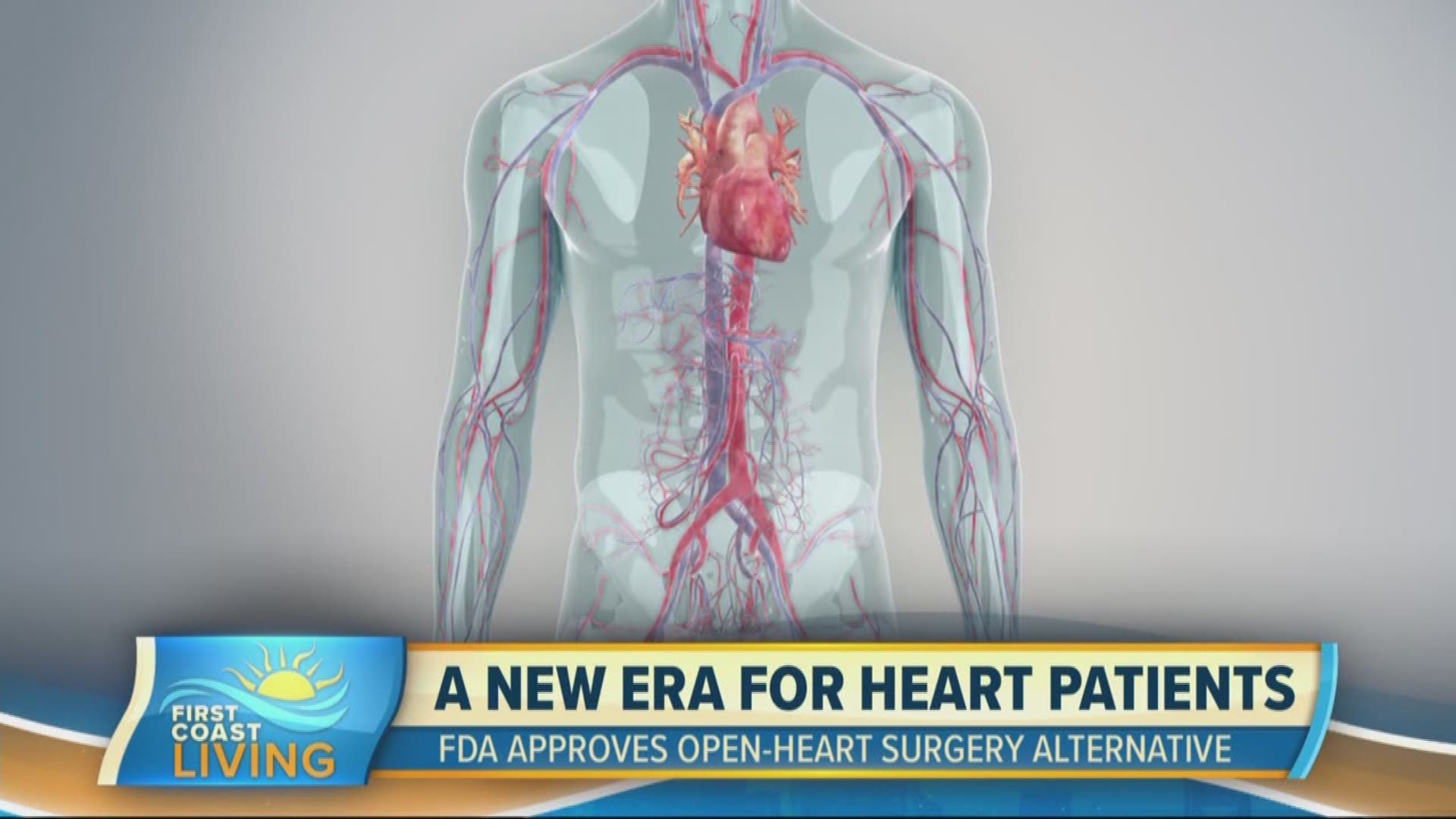 FDA Approval Means Growing Number of Patients Will Have Access to Minimally Invasive Alternative to Open-Heart Surgery.