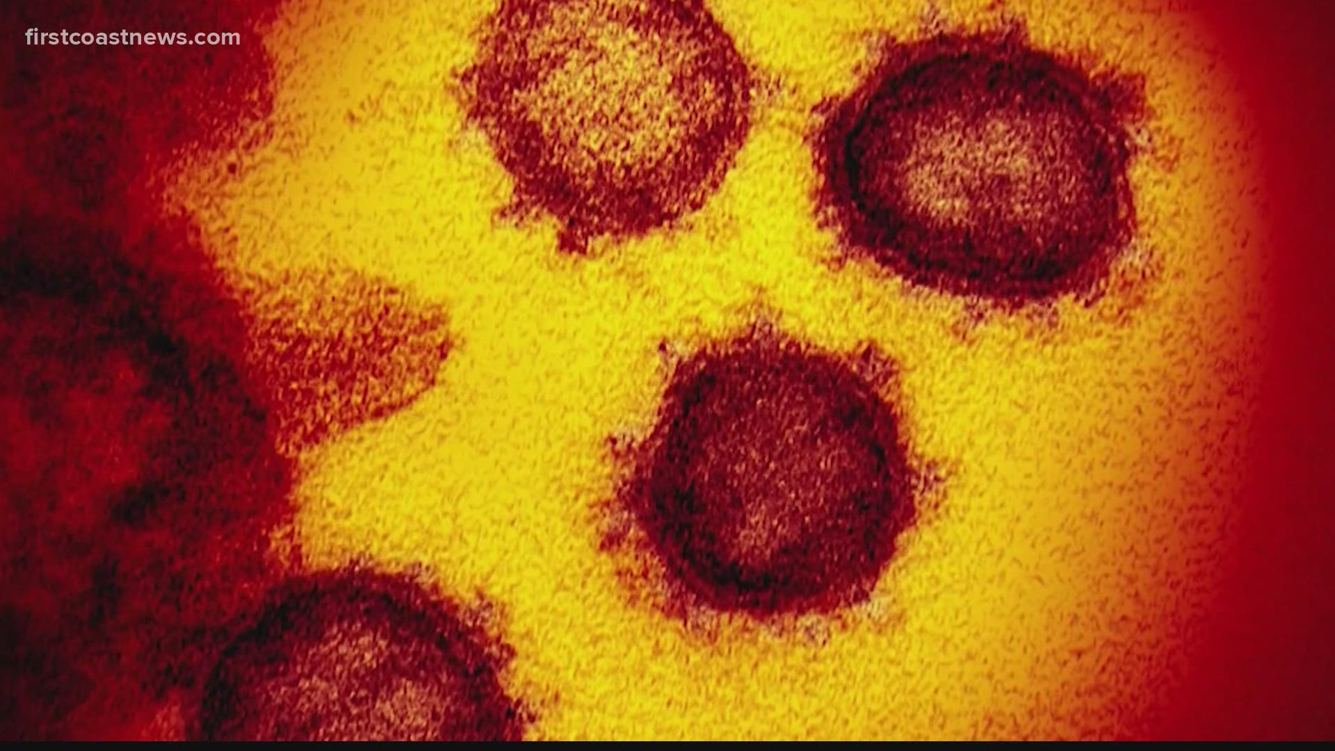 The Delta variant is now the most common strain of COVID-19 nationwide. However, it is unclear how many people are infected with the variant in NE Florida.