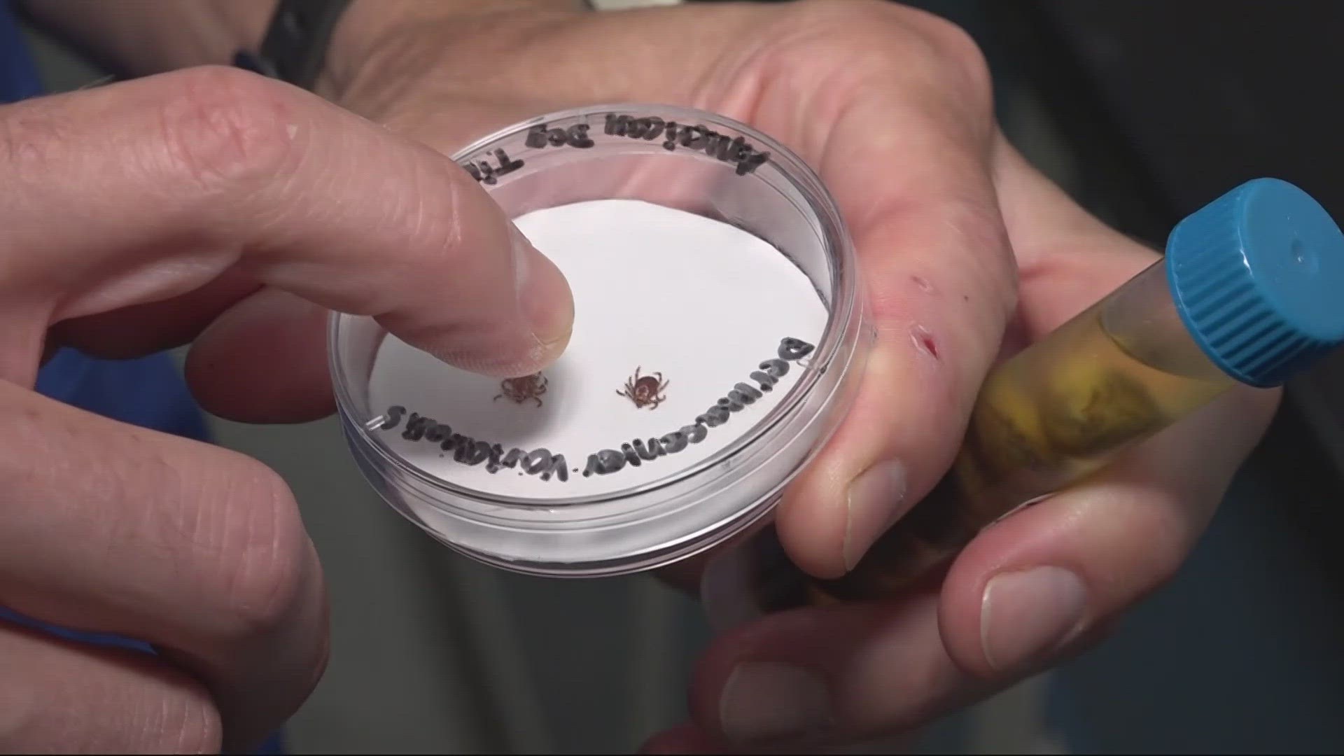 Researchers at the University of North Florida say official Lyme disease statistics underestimate the number of people with Lyme disease.