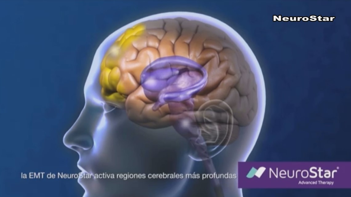Brain stimulation another treatment option for severe depression - Vimarsana News