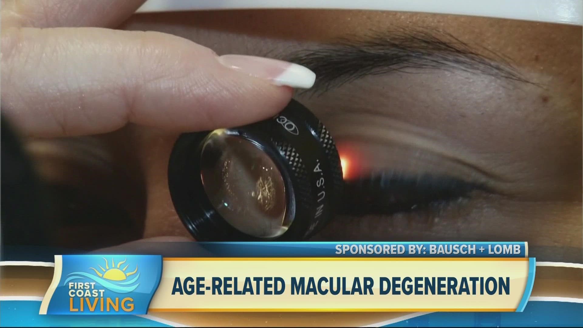 Age-related macular degeneration is an eye condition that can lead to you becoming blind especially if you are older than 50.