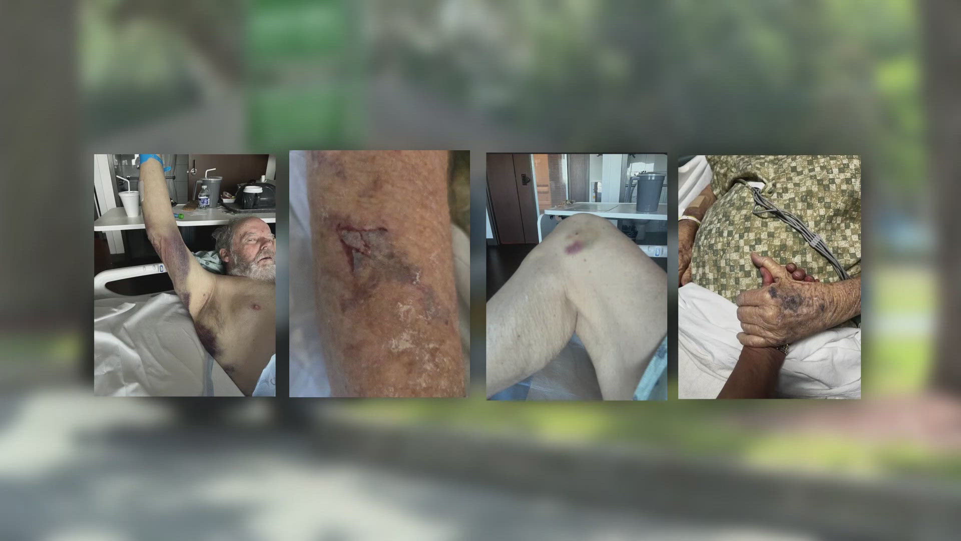 Anthony Diaz is being charged for attacking Julian Cohen at Orange Park Hospital. Cohen's family says they were informed late about the incident & demand answers. 