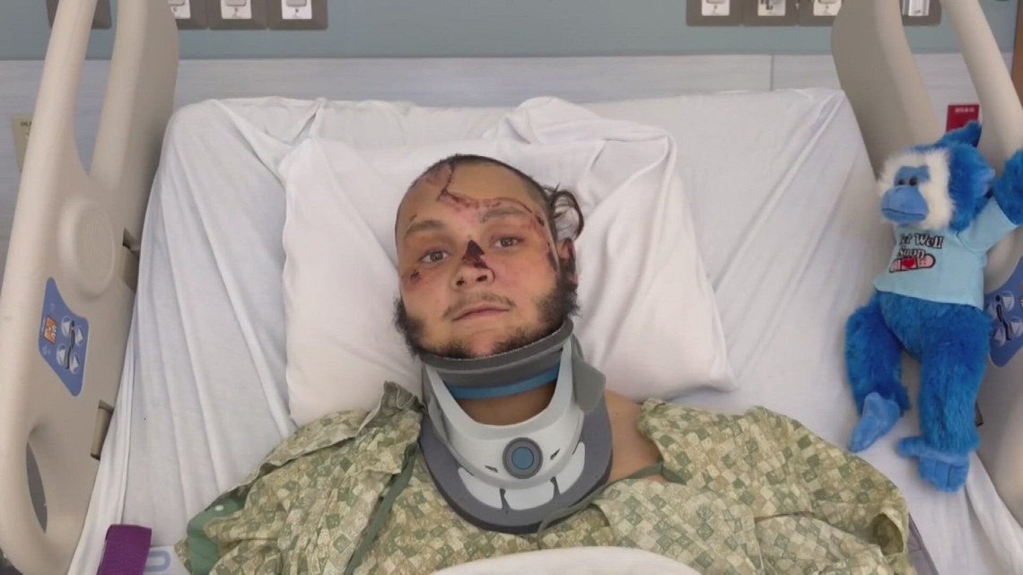 Florida Highway Patrol seeks driver in hit-and-run that severely injured moped rider