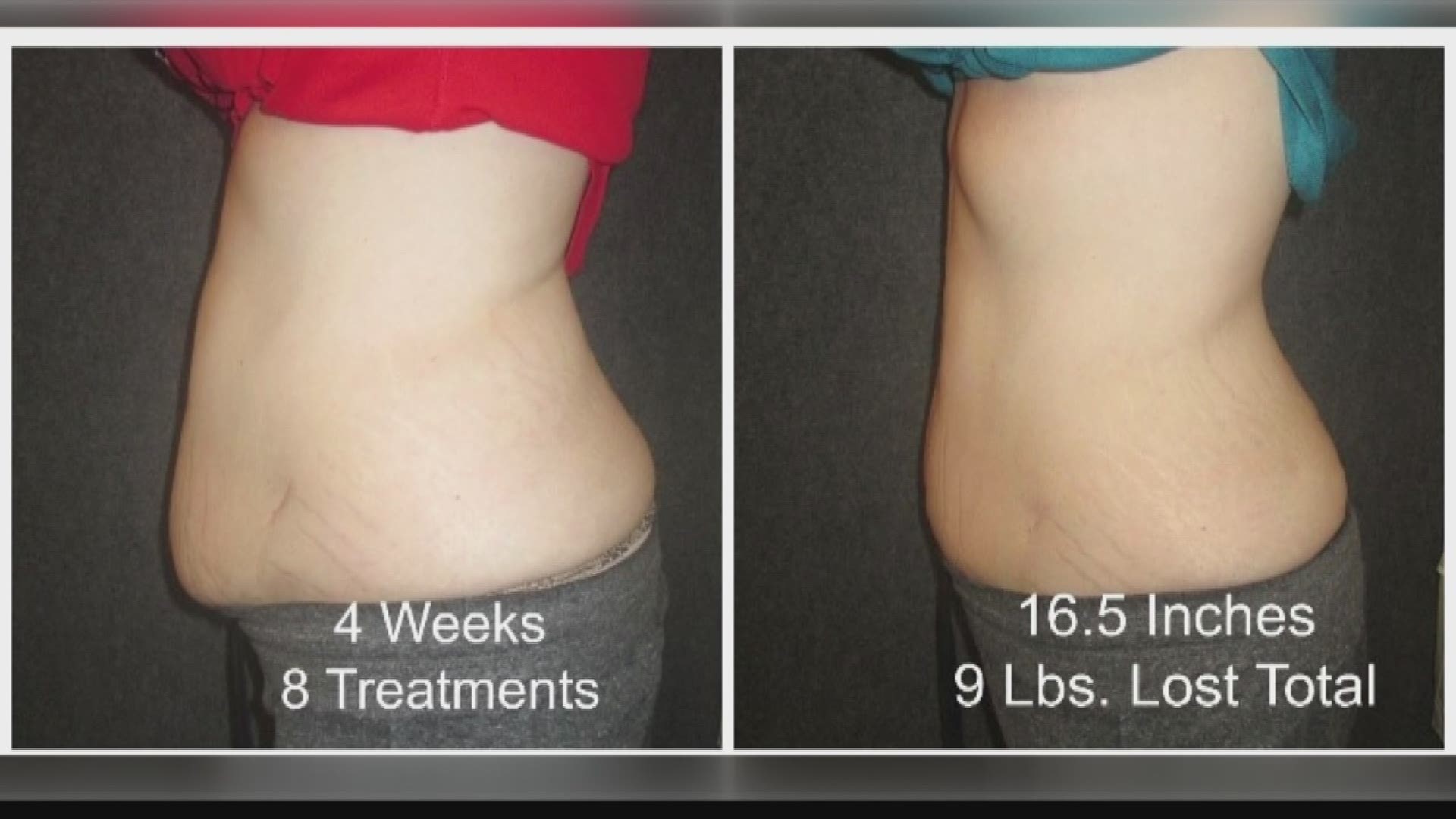 Slim down before, during and even after the holidays with this quick and easy treatment!