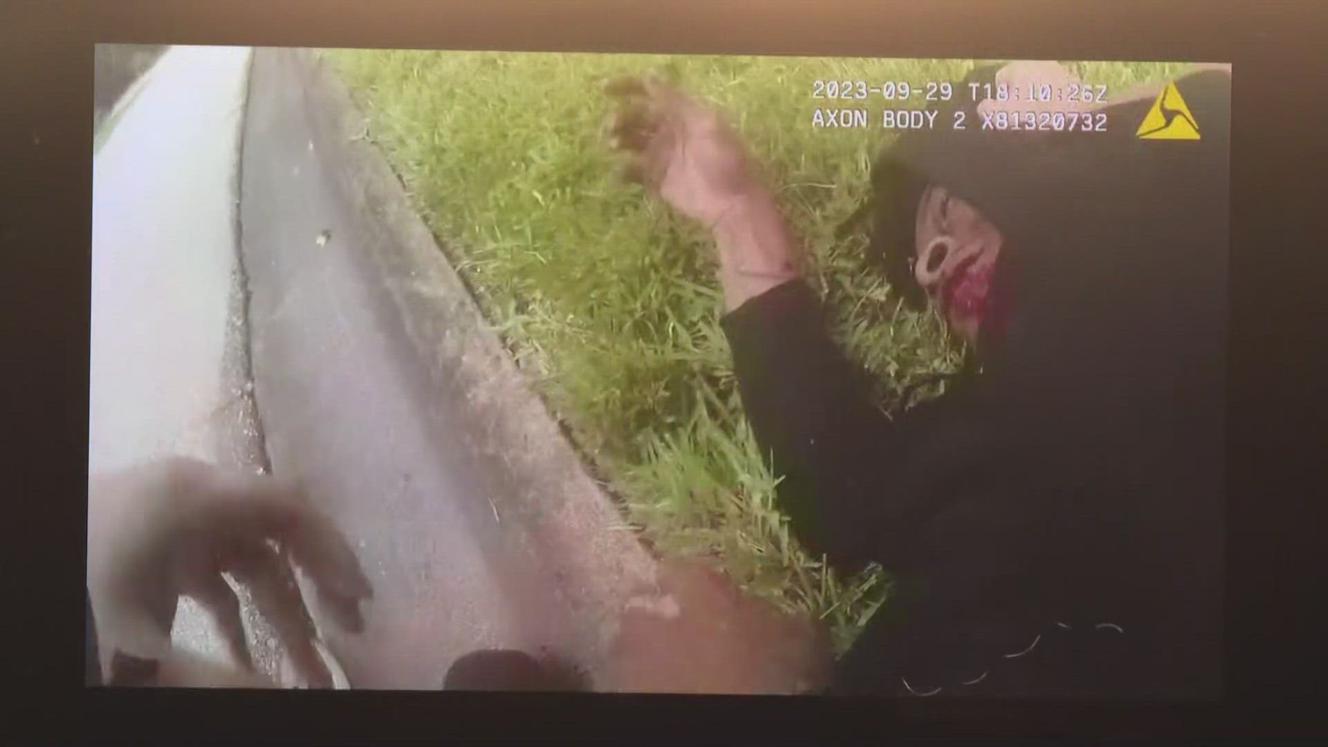 A video of Woods being beaten by police went viral Friday. The sheriff claims footage of him being kicked was 'altered,' but records show he was struck 17 times.