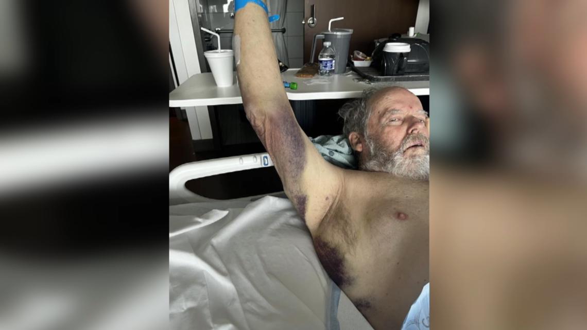 'How could you do that to an elderly person': 73-year-old man with dementia attacked by hospital worker at HCA Orange Park, family demands answers