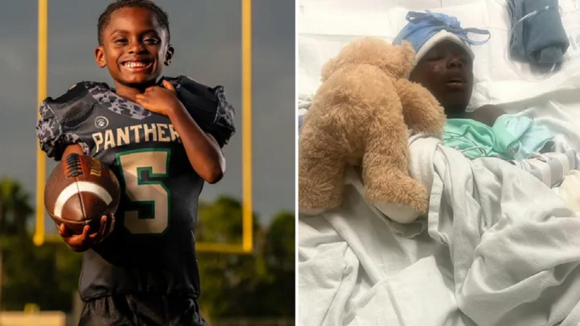 Family stresses safety as 7-year-old recovers from St. Johns County e-bike crash