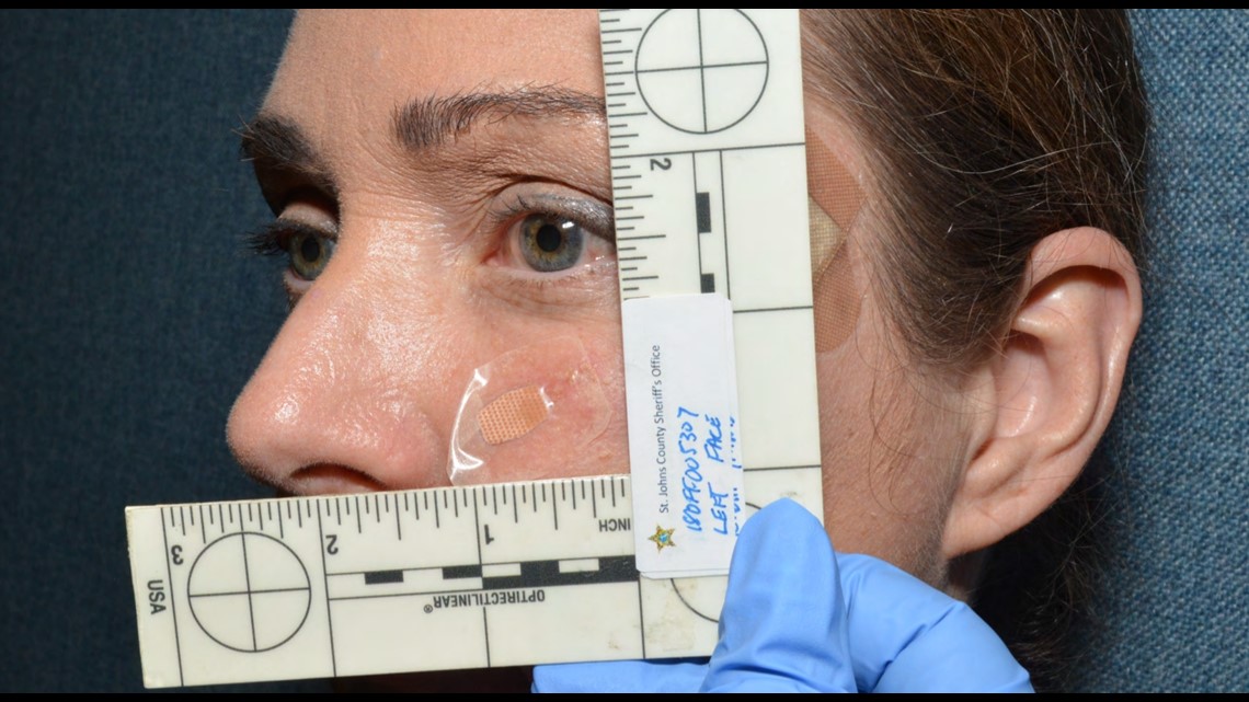 Kimberly Kessler's attorneys want to block doctor from testifying - Vimarsana News