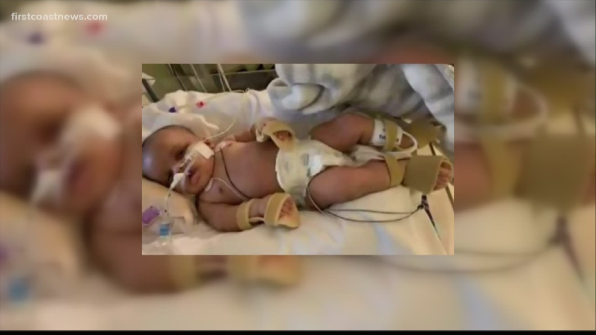 The family of Iyana McGraw tells First Coast News the infant, Milan, was taken off breathing tubes Sunday.