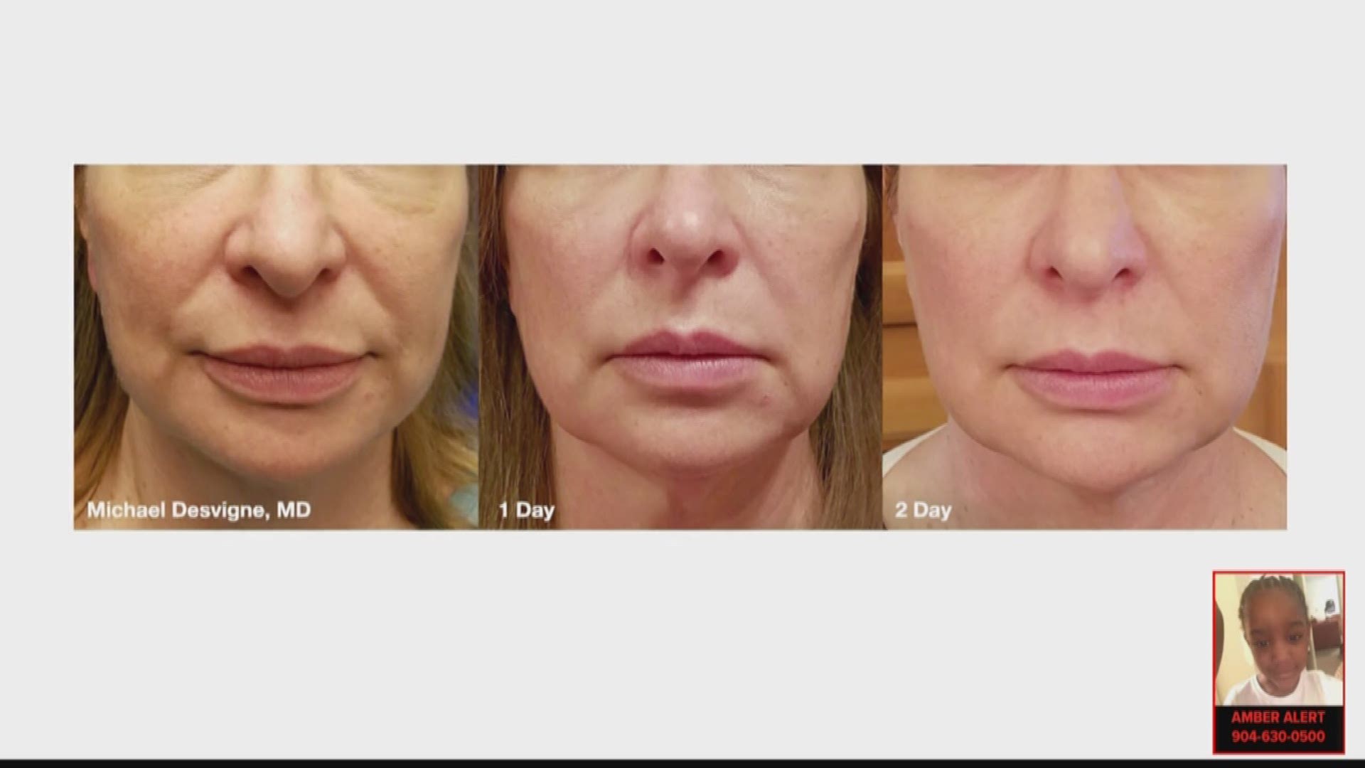 More and more people are wanting to enhance their natural look.