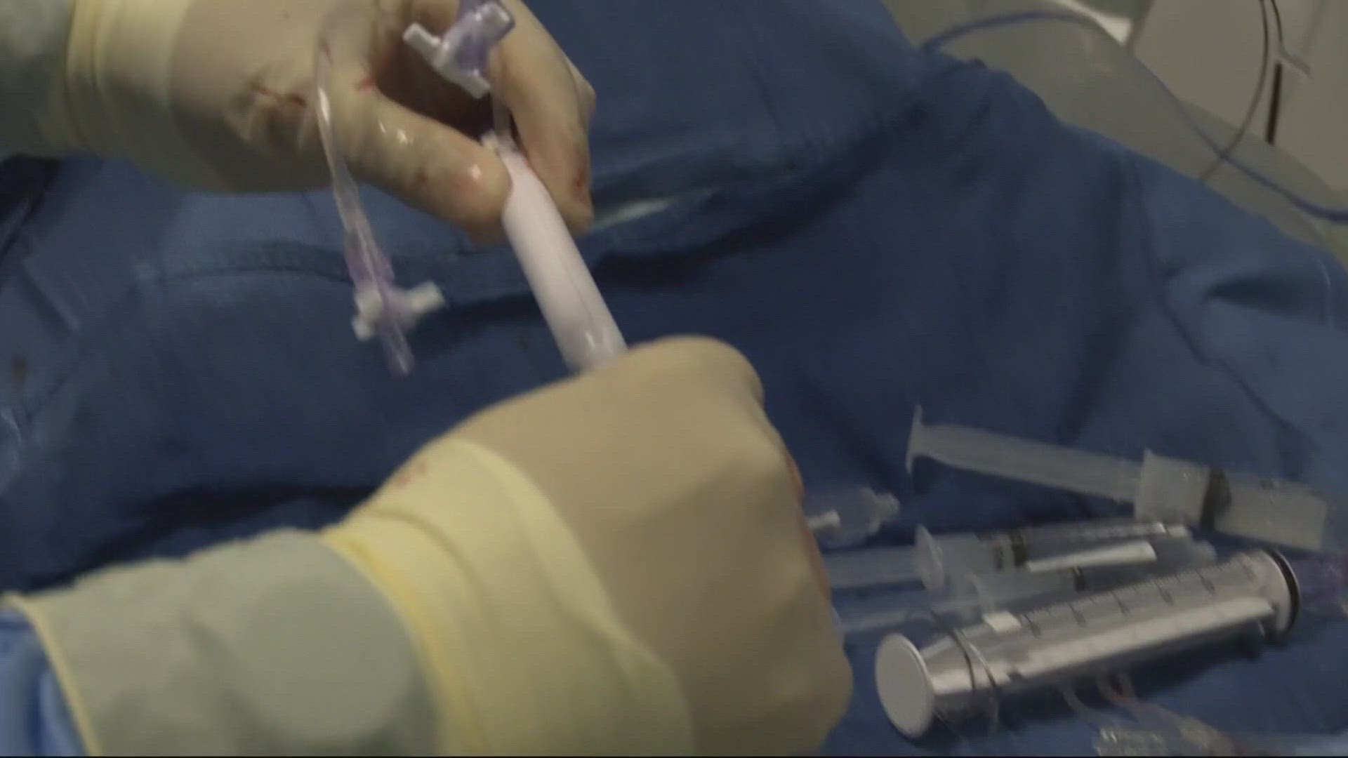 First Coast News was granted exclusive access of a blood clot removal procedure while the patient was still awake.