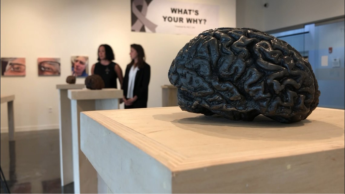 Get involved in UNF Alzheimer's study at art exhibit - Vimarsana News