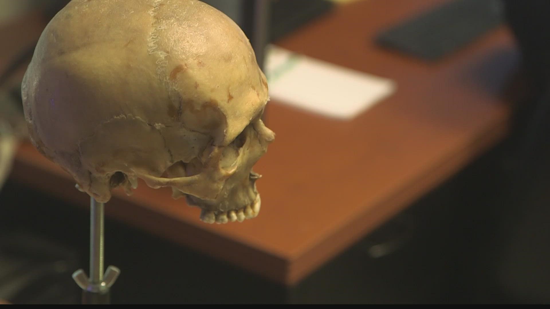To find a murderer, you first have to identify the victim. But what if the body is just skeletal remains?  That is where the work of forensic imaging comes in.