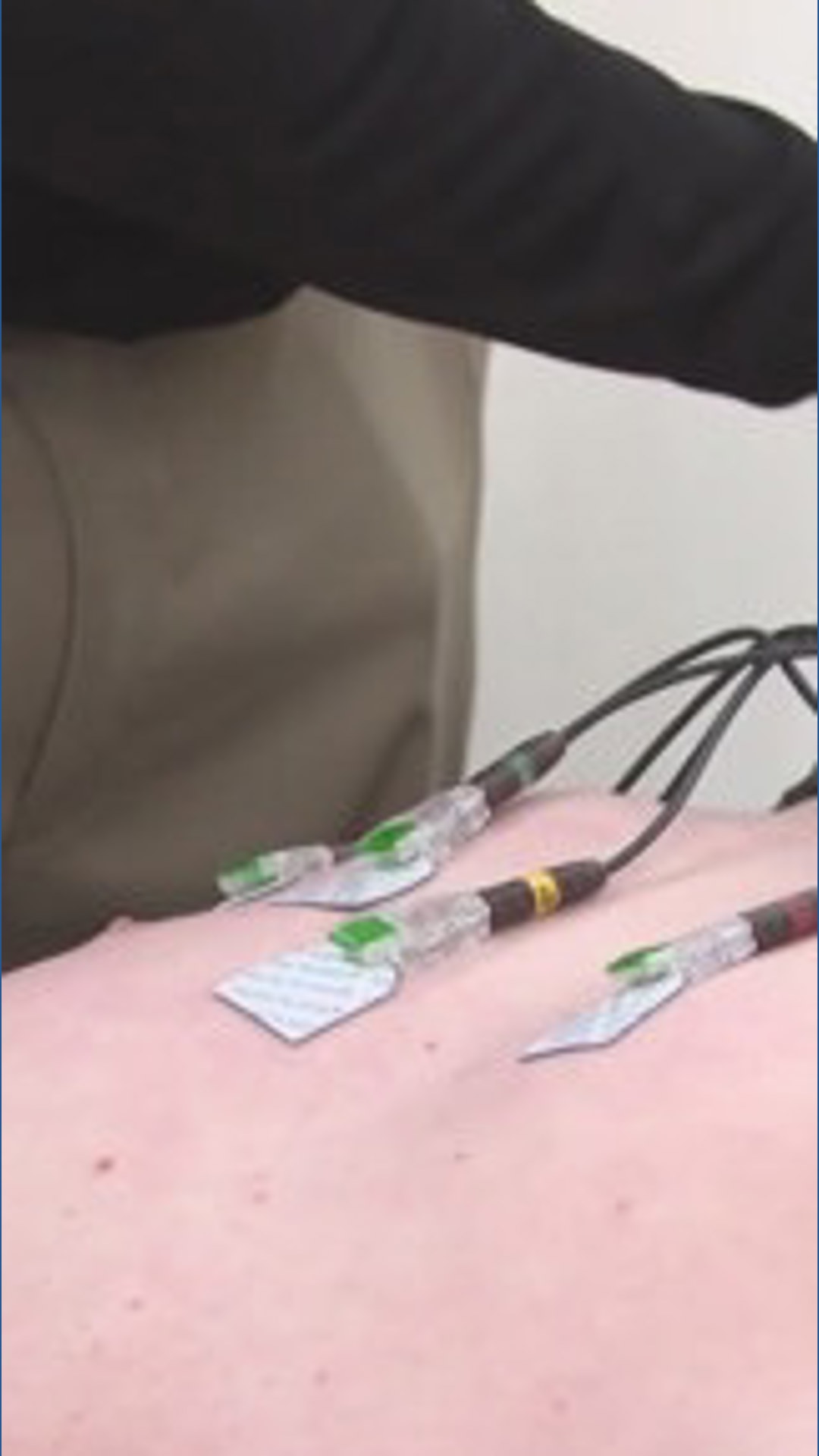 Florida to require heart screenings for high school athletes under new ...