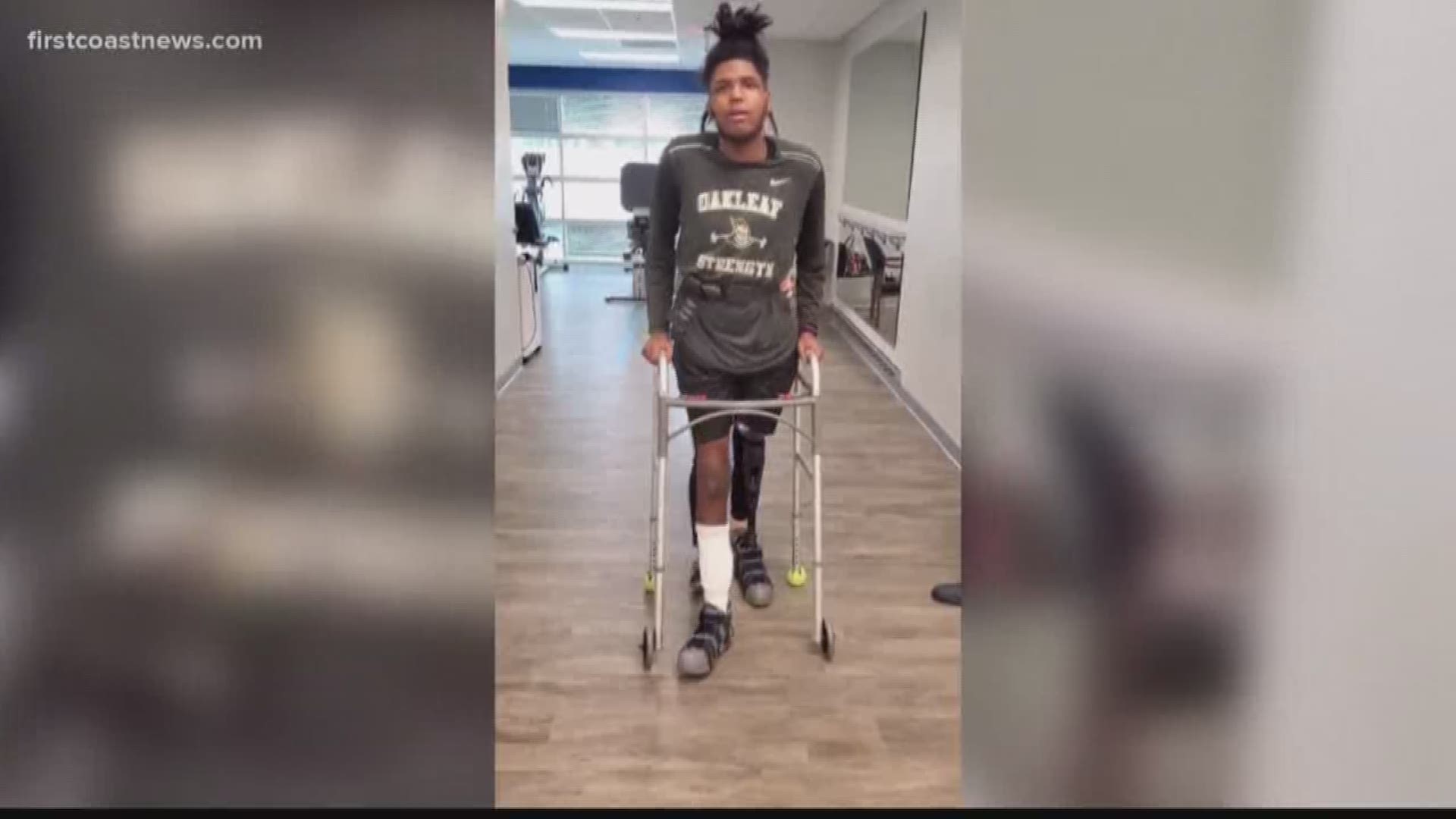 Stephanie Elder posted to Facebook a video of her son, Taj Richey, learning to walk with his new prosthetic leg Tuesday afternoon.