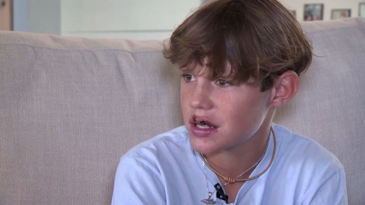 'I just started screaming': 13-year-old bit by shark while on family vacation in Florida Keys