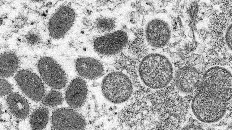 CDC: Infant becomes youngest Florida patient confirmed with monkeypox