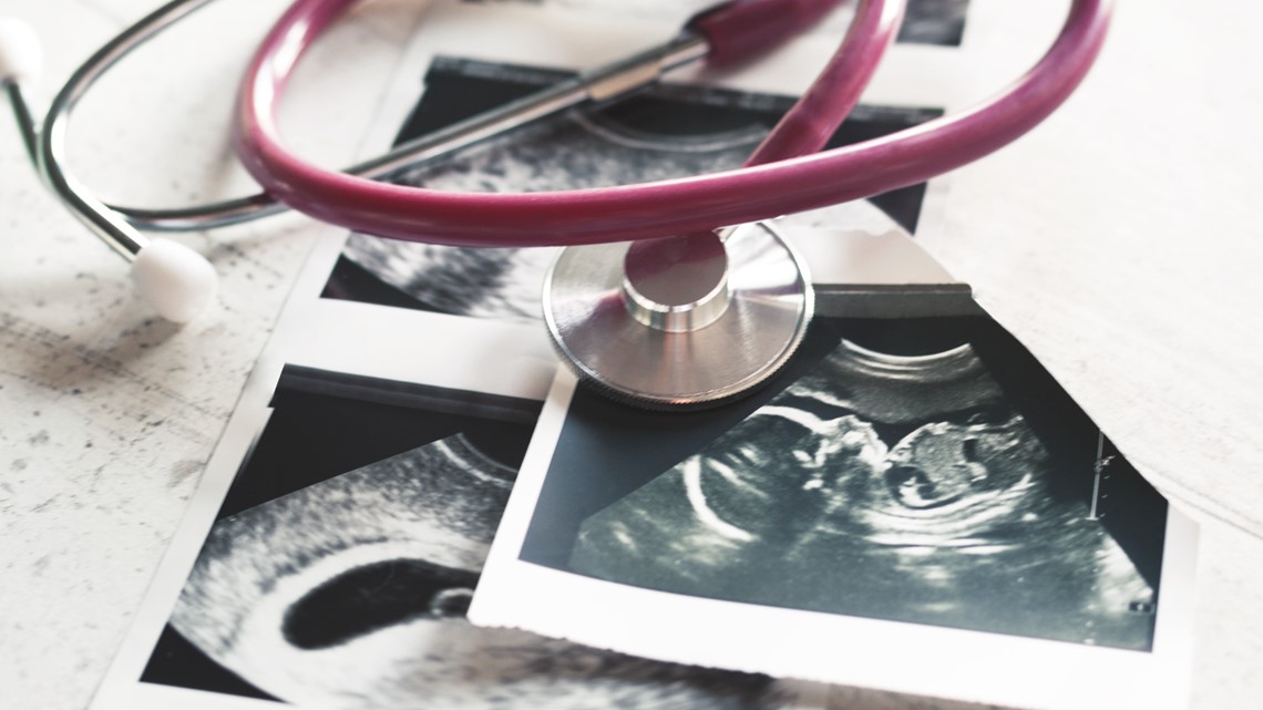 Florida lawmaker files 'heartbeat' abortion bill