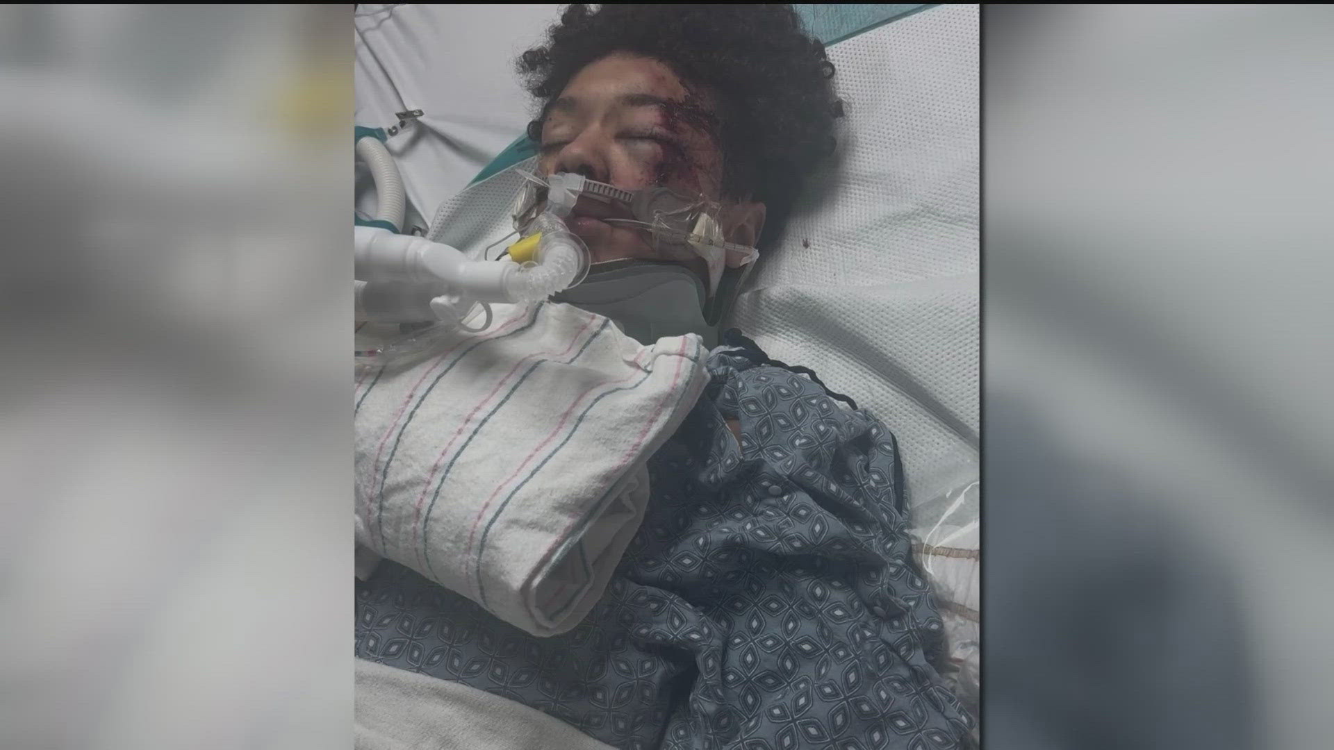 Family of a metro Atlanta boy hurt in deadly Alabama ATV crash questions safety at the park